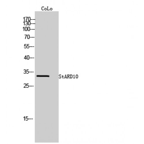 STARD10 Antibody - Western blot of StARD10 antibody