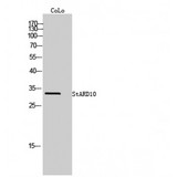 STARD10 Antibody - Western blot of StARD10 antibody
