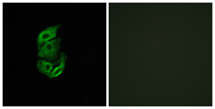 STARD13 Antibody - Immunofluorescence analysis of A549 cells, using STA13 Antibody. The picture on the right is blocked with the synthesized peptide.