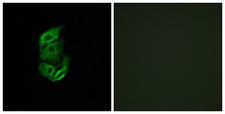 STARD13 Antibody - Immunofluorescence analysis of A549 cells, using STA13 Antibody. The picture on the right is blocked with the synthesized peptide.