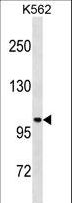 STARD13 Antibody - STARD13 Antibody western blot of K562 cell line lysates (35 ug/lane). The STARD13 antibody detected the STARD13 protein (arrow).
