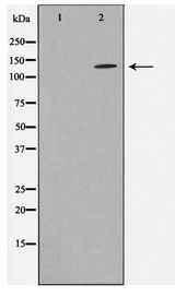 STARD13 Antibody - Western blot of K562 cell lysate using STA13 Antibody