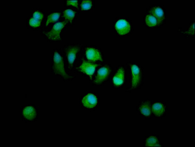 STARD13 Antibody - Immunofluorescence staining of MCF-7 cells diluted at 1:200, counter-stained with DAPI. The cells were fixed in 4% formaldehyde, permeabilized using 0.2% Triton X-100 and blocked in 10% normal Goat Serum. The cells were then incubated with the antibody overnight at 4°C.The Secondary antibody was Alexa Fluor 488-congugated AffiniPure Goat Anti-Rabbit IgG (H+L).