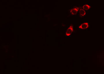 STARD13 Antibody - Staining HeLa cells by IF/ICC. The samples were fixed with PFA and permeabilized in 0.1% Triton X-100, then blocked in 10% serum for 45 min at 25°C. The primary antibody was diluted at 1:200 and incubated with the sample for 1 hour at 37°C. An Alexa Fluor 594 conjugated goat anti-rabbit IgG (H+L) antibody, diluted at 1/600, was used as secondary antibody.