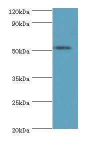 STARD3 / MLN64 Antibody - Western blot. All lanes: STARD3 Antibody at 6 ug/ml+MCF-7 whole cell lysate. Secondary antibody: Goat polyclonal to rabbit at 1:10000 dilution. Predicted band size: 51 kDa. Observed band size: 51 kDa.