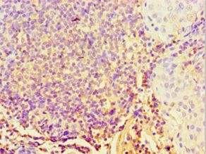 STARD3 / MLN64 Antibody - Immunohistochemistry of paraffin-embedded human tonsil tissue using antibody at 1:100 dilution.