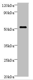 STARD3 / MLN64 Antibody - Western blot All lanes: STARD3 Antibody at 6µg/ml + MCF-7 whole cell lysate Secondary Goat polyclonal to rabbit IgG at 1/10000 dilution Predicted band size: 51, 49, 50 kDa Observed band size: 51 kDa