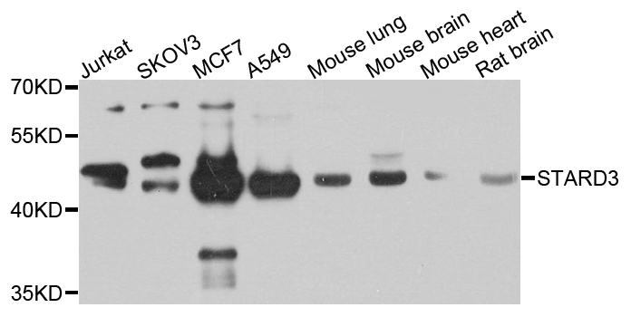 STARD3 / MLN64 Antibody - Western blot analysis of extracts of various cells.