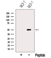 STARD3 / MLN64 Antibody - Western blot analysis of extracts of MCF-7 cells using MLN64 antibody. The lane on the left was treated with blocking peptide.
