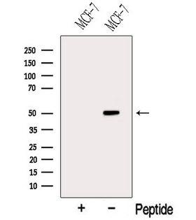 STARD3 / MLN64 Antibody - Western blot analysis of extracts of MCF-7 cells using MLN64 antibody. The lane on the left was treated with blocking peptide.