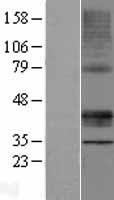 STARD3 / MLN64 Protein - Western validation with an anti-DDK antibody * L: Control HEK293 lysate R: Over-expression lysate