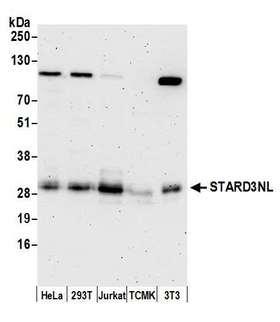 STARD3NL Antibody - Detection of human and mouse STARD3NL by western blot. Samples: Whole cell lysate (15 µg) from HeLa, HEK293T, Jurkat, mouse TCMK-1, and mouse NIH 3T3 cells prepared using NETN lysis buffer. Antibody: Affinity purified rabbit anti-STARD3NL antibody used for WB at 0.1 µg/ml. Detection: Chemiluminescence with an exposure time of 3 minutes.