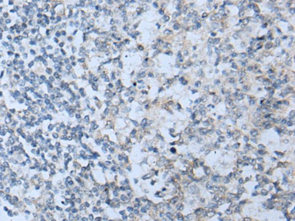 STARD4 Antibody - Immunohistochemistry of paraffin-embedded Human tonsil tissue  using STARD4 Polyclonal Antibody at dilution of 1:50(×200)