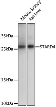 STARD4 Antibody - Western blot analysis of extracts of various cell lines using STARD4 Polyclonal Antibody at dilution of 1:1000.