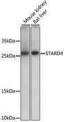 STARD4 Antibody - Western blot analysis of extracts of various cell lines using STARD4 Polyclonal Antibody at dilution of 1:1000.