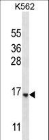 STARD5 Antibody - STARD5 Antibody western blot of K562 cell line lysates (35 ug/lane). The STARD5 antibody detected the STARD5 protein (arrow).