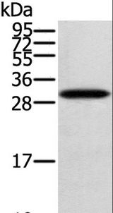 STARD5 Antibody - Western blot analysis of Human fetal brain tissue, using STARD5 Polyclonal Antibody at dilution of 1:400.