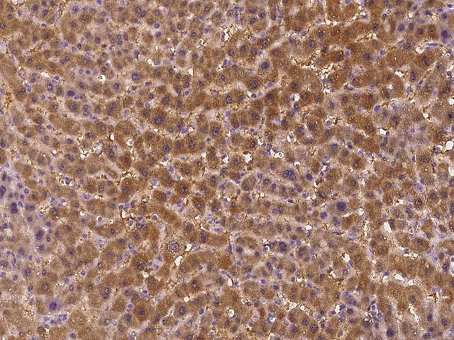 STARD5 Antibody - Immunochemical staining of human STARD5 in human liver with rabbit polyclonal antibody at 1:500 dilution, formalin-fixed paraffin embedded sections.