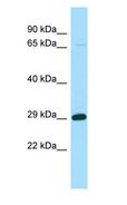 STARD6 Antibody - STARD6 antibody Western Blot of Fetal Kidney.  This image was taken for the unconjugated form of this product. Other forms have not been tested.