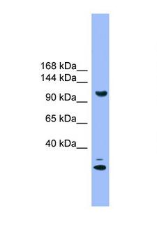 STARD8 Antibody - STARD8 antibody Western blot of 293T Cell lysate. Antibody concentration 1 ug/ml.  This image was taken for the unconjugated form of this product. Other forms have not been tested.