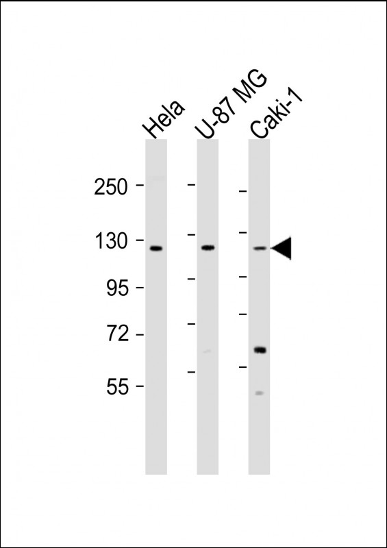 STARD8 Antibody - All lanes: Anti-STARD8 Antibody (N-Term) at 1:1000-1:2000 dilution. Lane 1: HeLa whole cell lysate. Lane 2: U-87 MG whole cell lysate. Lane 3: Caki-1 whole cell lysate Lysates/proteins at 20 ug per lane. Secondary Goat Anti-Rabbit IgG, (H+L), Peroxidase conjugated at 1:10000 dilution. Predicted band size: 112 kDa. Blocking/Dilution buffer: 5% NFDM/TBST.