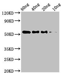 STARD9 Antibody - Western Blot Positive WB detected in Recombinant protein All lanes: STARD9 antibody at 3.2µg/ml Secondary Goat polyclonal to rabbit IgG at 1/50000 dilution predicted band size: 54 kDa observed band size: 54 kDa