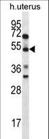 STARS / ABRA Antibody - ABRA Antibody western blot of human normal Uterus tissue lysates (35 ug/lane). The ABRA antibody detected the ABRA protein (arrow).
