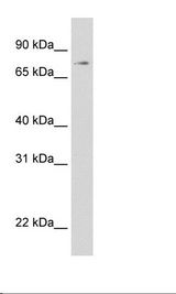STAT1 Antibody - Recombinant STAT1 protein Cell Lysate.  This image was taken for the unconjugated form of this product. Other forms have not been tested.