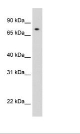 STAT1 Antibody - Recombinant STAT1 protein Cell Lysate.  This image was taken for the unconjugated form of this product. Other forms have not been tested.