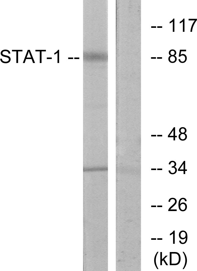 STAT1 Antibody - Western blot analysis of lysates from COLO205 cells, using STAT1 Antibody. The lane on the right is blocked with the synthesized peptide.