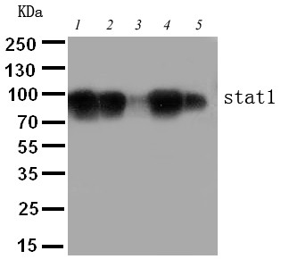 STAT1 Antibody - WB of STAT1 antibody. Lane 1: MM451 Cell Lysate. Lane 2: HELA Cell Lysate. Lane 3: HT1080 Cell Lysate. Lane 4: SW620 Cell Lysate. Lane 5: JURKAT Cell Lysate.