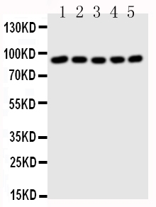 STAT1 Antibody - Anti-STAT1 antibody, Western blotting All lanes: Anti STAT1 at 0.5ug/ml Lane 1: MM451 Whole Cell Lysate at 40ug Lane 2: HELA Whole Cell Lysate at 40ug Lane 3: HT1080 Whole Cell Lysate at 40ug Lane 4: SW620 Whole Cell Lysate at 40ug Lane 5: JURKAT Whole Cell Lysate at 40ug Predicted bind size: 87KD Observed bind size: 87KD