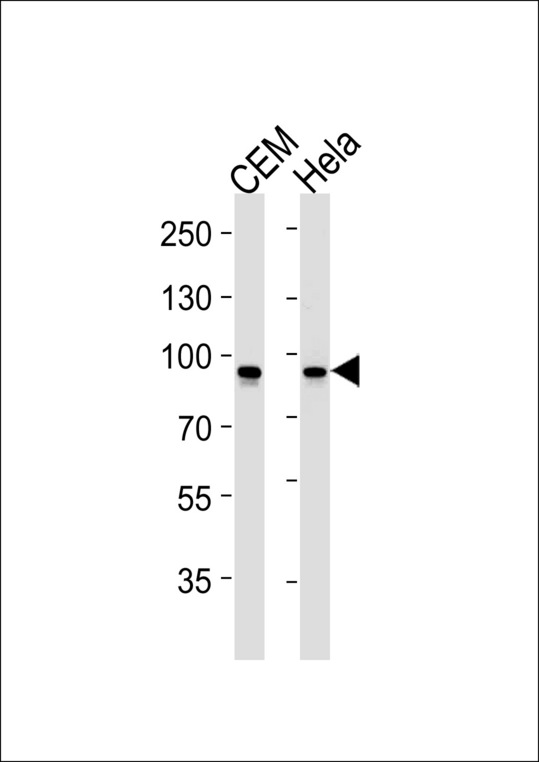 STAT1 Antibody - STAT1 Antibody western blot of CEM,HeLa cell line lysates (35 ug/lane). The STAT1 antibody detected the STAT1 protein (arrow).