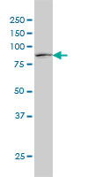 STAT1 Antibody - STAT1 monoclonal antibody (M01), clone 1A8 Western Blot analysis of STAT1 expression in HeLa.