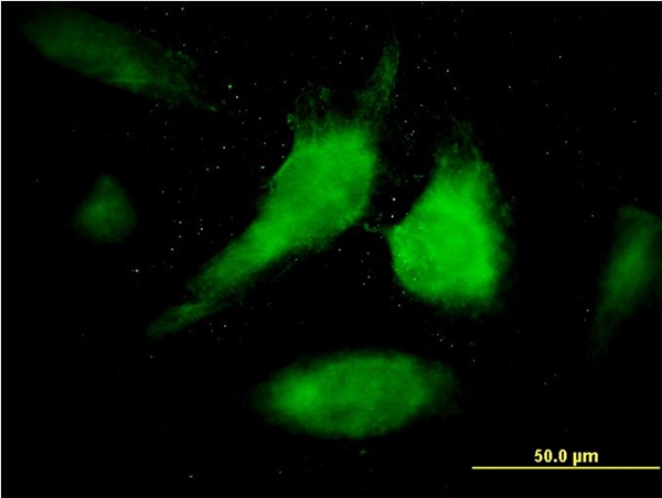 STAT1 Antibody - Immunofluorescence of monoclonal antibody to STAT1 on HeLa cell. [antibody concentration 40 ug/ml]