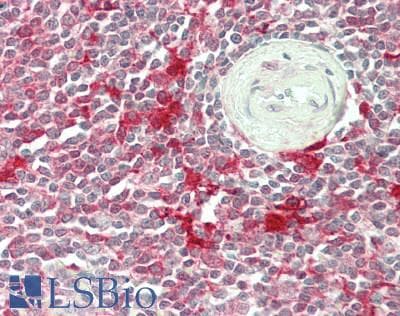 STAT1 Antibody - Human Spleen: Formalin-Fixed, Paraffin-Embedded (FFPE)