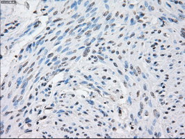 STAT1 Antibody - IHC of paraffin-embedded endometrium tissue using anti-STAT1 mouse monoclonal antibody. (Dilution 1:50).