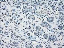 STAT1 Antibody - IHC of paraffin-embedded breast tissue using anti-STAT1 mouse monoclonal antibody. (Dilution 1:50).