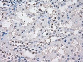 STAT1 Antibody - IHC of paraffin-embedded Kidney tissue using anti-STAT1 mouse monoclonal antibody. (Dilution 1:50).