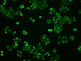 STAT1 Antibody - Immunofluorescent staining of HT29 cells using anti-STAT1 mouse monoclonal antibody.