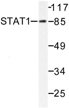 STAT1 Antibody - Western blot of STAT1 (G695) pAb in extracts from COLO205 cells.