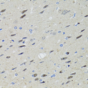 STAT1 Antibody - Immunohistochemistry of paraffin-embedded rat brain using STAT1 antibodyat dilution of 1:100 (40x lens).