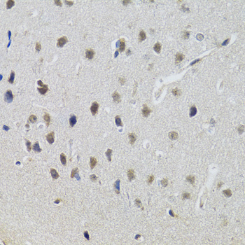STAT1 Antibody - Immunohistochemistry of paraffin-embedded mouse brain using STAT1 antibodyat dilution of 1:100 (40x lens).