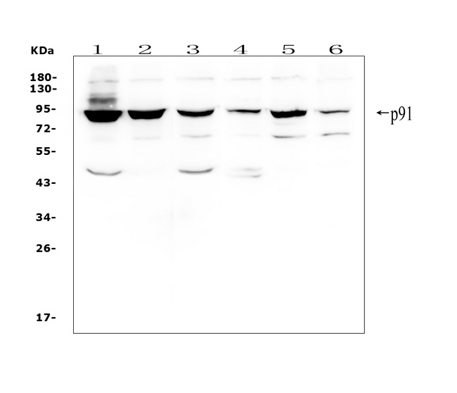 STAT1 Antibody - Western blot analysis of STAT1 using anti-STAT1 antibody. Electrophoresis was performed on a 5-20% SDS-PAGE gel at 70V (Stacking gel) / 90V (Resolving gel) for 2-3 hours. The sample well of each lane was loaded with 50ug of sample under reducing conditions. Lane 1: human Hela whole cell lysates, Lane 2: human PC-3 whole cell lysates, Lane 3: human Caco-2 whole cell lysates, Lane 4: human A549 whole cell lysates, Lane 5: human K562 whole cell lysates, Lane 6: human Raji whole cell lysates. After Electrophoresis, proteins were transferred to a Nitrocellulose membrane at 150mA for 50-90 minutes. Blocked the membrane with 5% Non-fat Milk/ TBS for 1.5 hour at RT. The membrane was incubated with rabbit anti-STAT1 antigen affinity purified polyclonal antibody at 0.5 µg/mL overnight at 4°C, then washed with TBS-0.1% Tween 3 times with 5 minutes each and probed with a goat anti-rabbit IgG-HRP secondary antibody at a dilution of 1:10000 for 1.5 hour at RT. The signal is developed using an Enhanced Chemiluminescent detection (ECL) kit with Tanon 5200 system. A specific band was detected for STAT1 at approximately 91KD. The expected band size for STAT1 is at 87KD.
