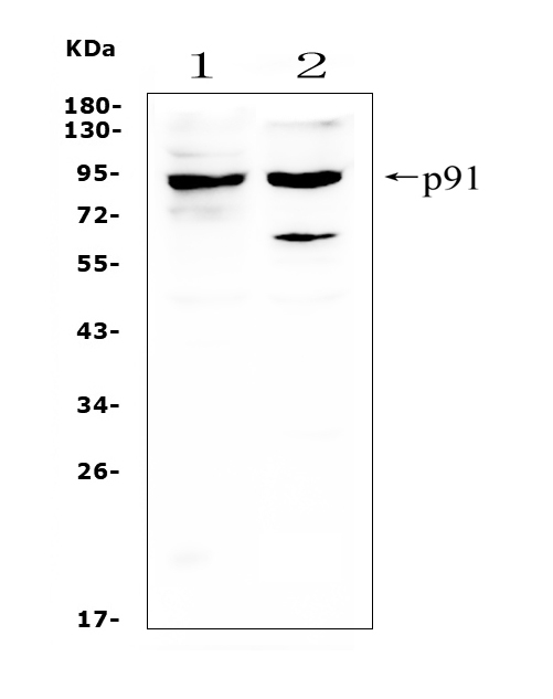 STAT1 Antibody - Western blot analysis of STAT1 using anti-STAT1 antibody. Electrophoresis was performed on a 5-20% SDS-PAGE gel at 70V (Stacking gel) / 90V (Resolving gel) for 2-3 hours. The sample well of each lane was loaded with 50ug of sample under reducing conditions. Lane 1: rat thymus tissue lysates, Lane 2: mouse thymus tissue lysates, After Electrophoresis, proteins were transferred to a Nitrocellulose membrane at 150mA for 50-90 minutes. Blocked the membrane with 5% Non-fat Milk/ TBS for 1.5 hour at RT. The membrane was incubated with rabbit anti-STAT1 antigen affinity purified polyclonal antibody at 0.5 µg/mL overnight at 4°C, then washed with TBS-0.1% Tween 3 times with 5 minutes each and probed with a goat anti-rabbit IgG-HRP secondary antibody at a dilution of 1:10000 for 1.5 hour at RT. The signal is developed using an Enhanced Chemiluminescent detection (ECL) kit with Tanon 5200 system. A specific band was detected for STAT1 at approximately 91KD. The expected band size for STAT1 is at 87KD.