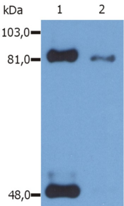 STAT1 Antibody - Western Blotting analysis (reducing conditions) of phosphorylated STAT1 (Ser727) in IFN-gamma treated HeLa human cervix carcinoma cell line using anti-Phospho STAT1 (PSM1).  Lane 1: immunoprecipitated material by anti-STAT1 (SM2)  Lane 2: original whole cell lysate
