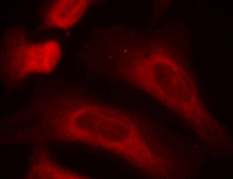 STAT1 Antibody - Immunofluorescence staining of methanol-fixed Hela cells.
