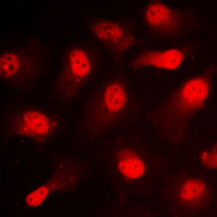 STAT1 Antibody - Immunofluorescent analysis of STAT1 (pS727) staining in NIH3T3 cells. Formalin-fixed cells were permeabilized with 0.1% Triton X-100 in TBS for 5-10 minutes and blocked with 3% BSA-PBS for 30 minutes at room temperature. Cells were probed with the primary antibody in 3% BSA-PBS and incubated overnight at 4 C in a humidified chamber. Cells were washed with PBST and incubated with a DyLight 594-conjugated secondary antibody (red) in PBS at room temperature in the dark. DAPI was used to stain the cell nuclei (blue).