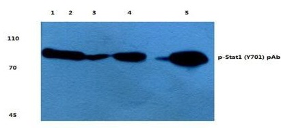 STAT1 Antibody - Western blot analysis of Anti-STAT1 Antibody (1:500). Lane 1: A549 cell lysate treated w/ IFN-a. Lane 2: DLD cell lysate treated w/ IFN-a. Lane 3: H9C2 cell lysate treated w/ IFN-a. Lane 4: Raw246.7 cell lysate treated w/ IFN-a. Lane 5: H9C2 cell lysate treated w/ LPS.