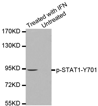 STAT1 Antibody - Western blot analysis of extracts from HeLa cells treated with IFN or untreated.